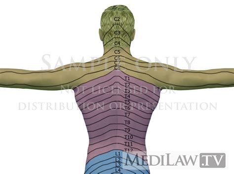 Dermatome Map Cervical Spine | Dermatome Map