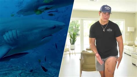 Man makes incredible recovery after suffering shark bite in Florida Keys – NBC 6 South Florida