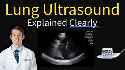 Lung Ultrasound Explained (Point of Care, Bedside, Clinical) - YouTube