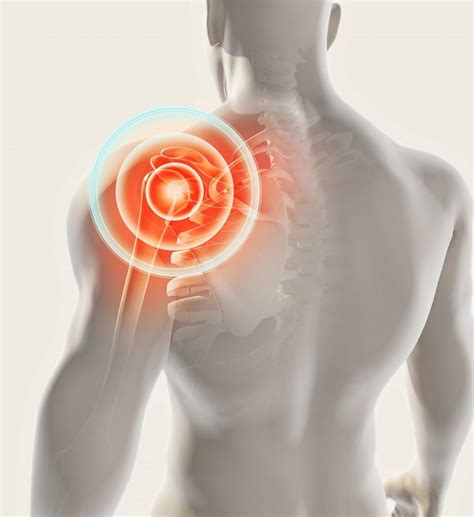 Common Causes of a Dislocated Shoulder: IASM: Orthopedic Surgeons