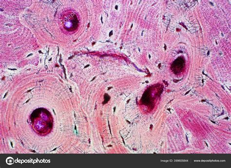 Histology Human Compact Bone Tissue Microscope View Education Muscle ...