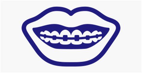 Free Braces Cliparts, Download Free Braces Cliparts png images, Free ClipArts on Clipart Library