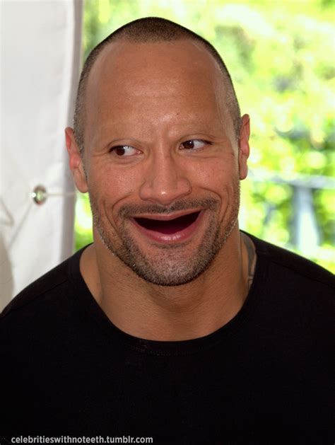 Celebrities Without Eyebrows And Teeth