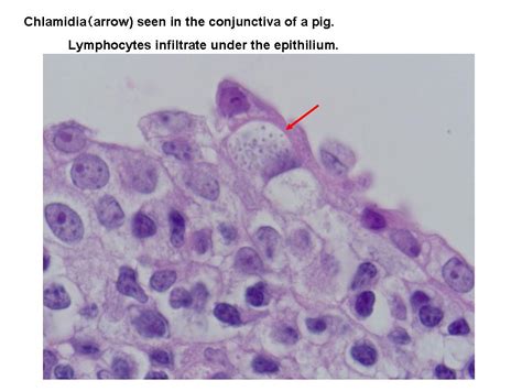 NIAH:NIAH Pathogenic Organisms Observed by Electron Microscope:Chlamydia