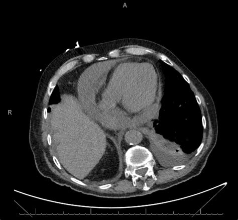 Shock: Differential Diagnosis - The Medical Media Review