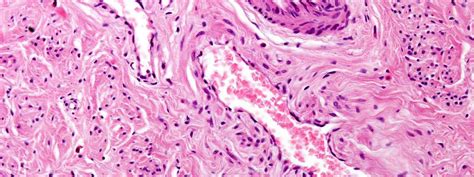 Endothelium Histology