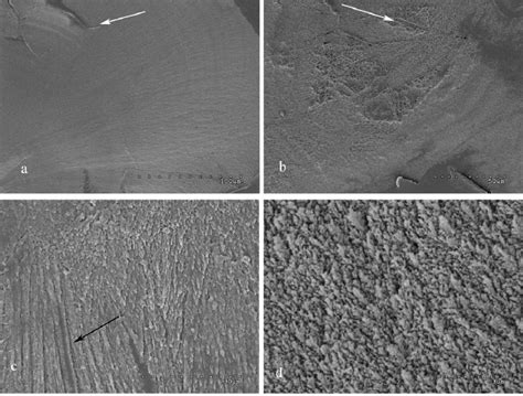 -Scanning electron micrograph showing anchovy otolith microstructure.... | Download Scientific ...