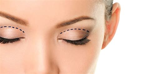 Upper Eyelid Surgery in Jacksonville, FL | Dr. Amy Kulak