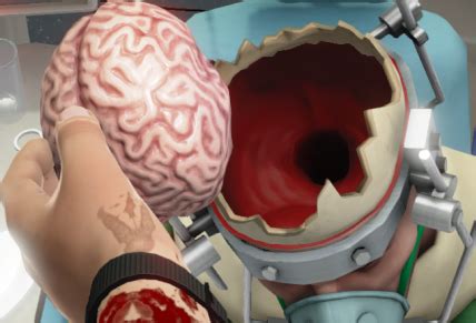 How To Complete The Brain Transplant – Steam Solo