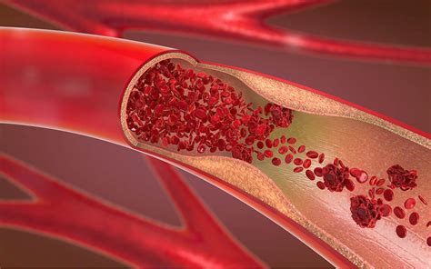 The Type of Blood Vessel Damage Determines Its Path to Regeneration | Research News - University ...