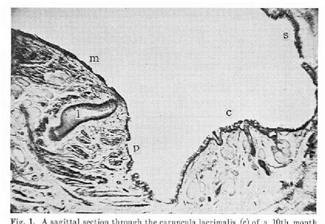 Figure 1 from On the Histology and Innervation of Caruncula Lacrimalis ...