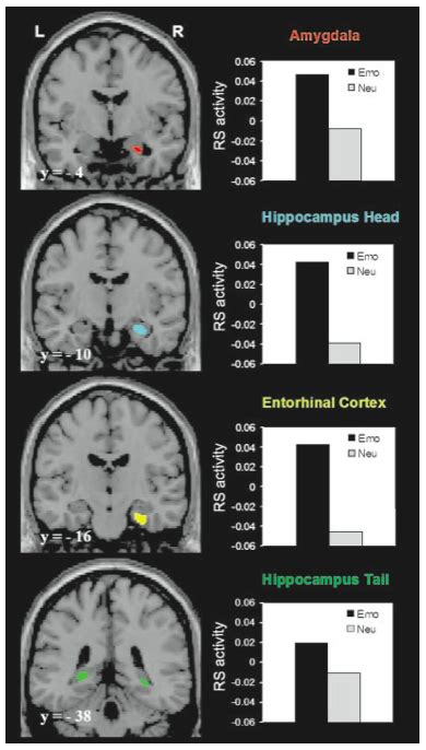 The Neural Correlates of Emotional Memory Retrieval | Emotion, Brain ...