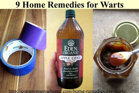 Home Remedies for Warts