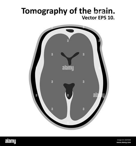 Magnetic resonance imaging of the brain. Cross section of the brain with MRI / CT scan. Vector ...