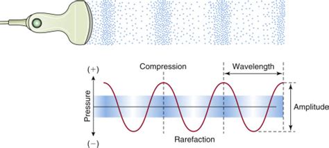 Ultrasound Physics | Radiology Key
