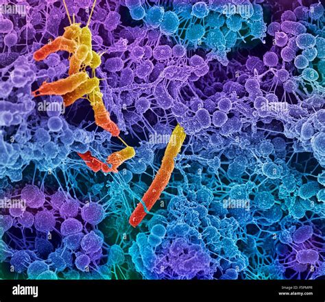 Oral bacteria. Coloured scanning electron micrograph (SEM) of mixed Stock Photo, Royalty Free ...