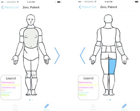 [DIAGRAM] Contusion Wound Diagram - MYDIAGRAM.ONLINE