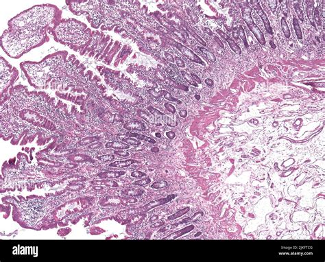 Ascending Colon Histology