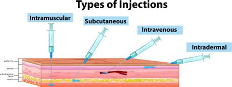 Types Of Injection Sites