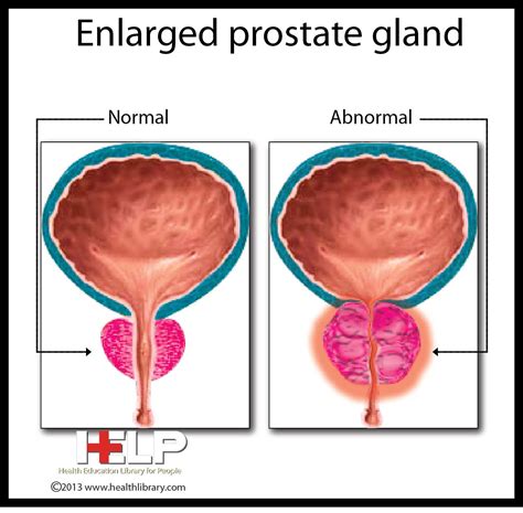 Prostate Gland Anatomy