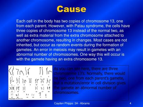 PPT - Patau Syndrome PowerPoint Presentation - ID:6905046