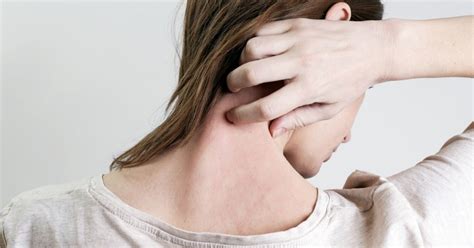 Eczema and Stress: The Connection Between Eczema and Mental Health