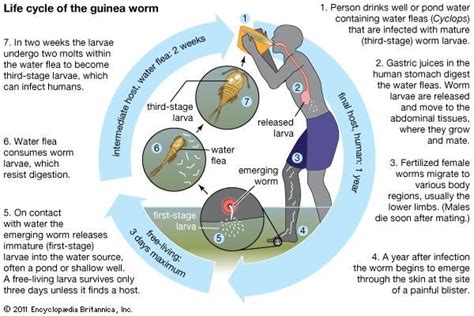 guinea worm disease | Definition, Infection, Treatment, & Eradication | Britannica.com