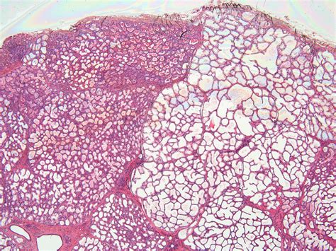 Lactating mammary gland histology (40 X) - Anatomicum.com