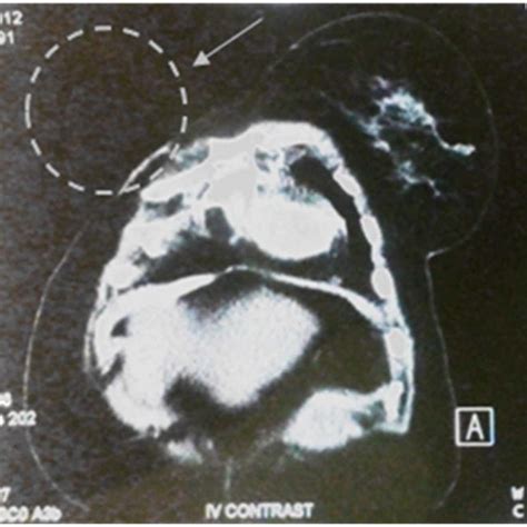 (PDF) Biomedical Imaging Techniques