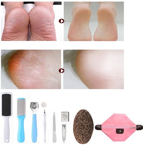 Pedicure Kit Spa Home Pedicure Kit 10 in 1 Stainless Steel Foot Scrubber Tool Foot Rasp ...