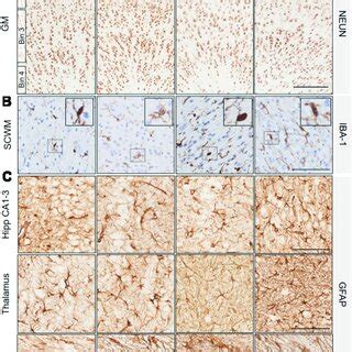 (A) Representative images of NeuN-positive cells indicating mature ...