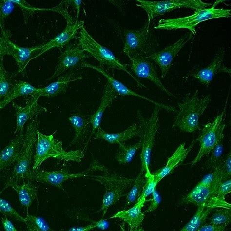 Human Hepatic Stellate Cells - Innoprot Hepatic Cell System