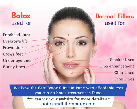 botox and fillers training near me - Hildegarde Mcdade