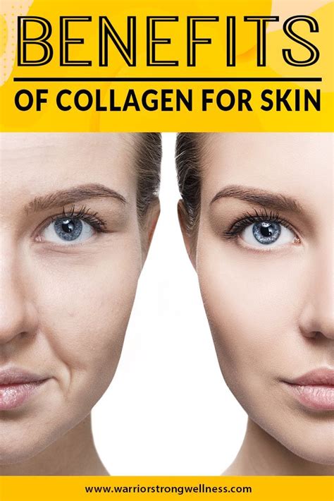 Benefits of Collagen for Skin | Collagen benefits, Collagen, Collagen ...