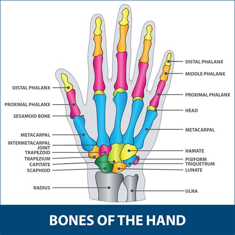 Fractured Fingers | Florida Orthopaedic Institute