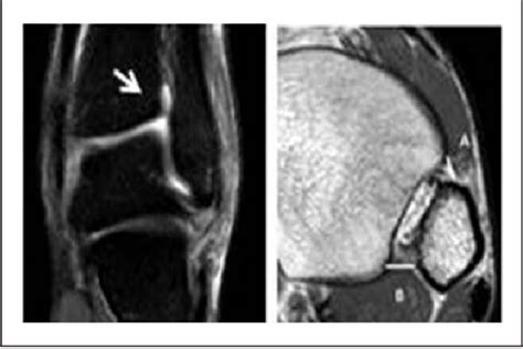 Figure 3 from The Lambda Sign | Semantic Scholar