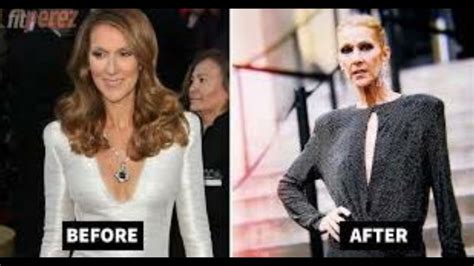 Celine dion weight loss reason: The basic truth about my Weight loss. - YouTube