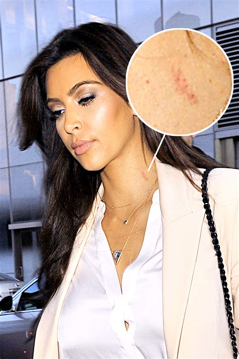 Kim Kardashian, Rihanna, and More Stars Who've Been Spotted With Hickies on Their Necks - Life ...