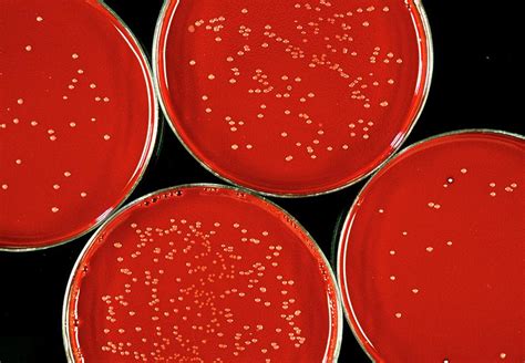 Bacterial Cultures Photograph by R.a. Longuehaye/science Photo Library - Fine Art America