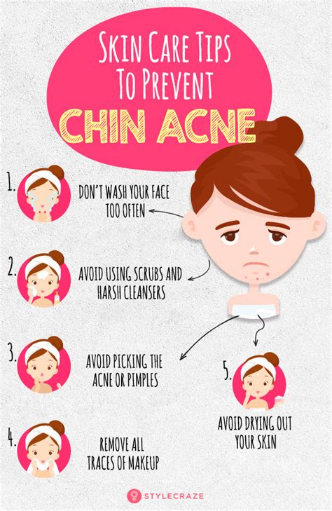 Chin Acne & Acne: Reasons, Therapy, And Skin Care Tips - Health and ...