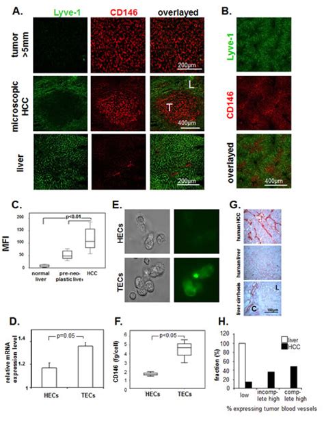 Selective targeting of liver cancer with the endothelial marker CD146 | Oncotarget