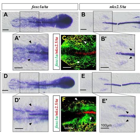 Zebrafish heart development. (A–G) Lateral and dorsal views of heart ...