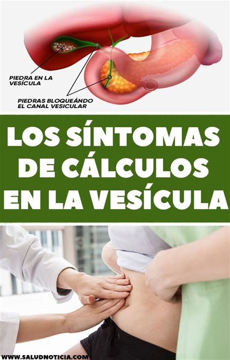 Que Es La Vesícula Los Síntomas De Cálculos En La Vesícula - Prefixword