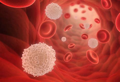 Hyperviscosity syndrome causes, symptoms, diagnosis, treatment & prognosis