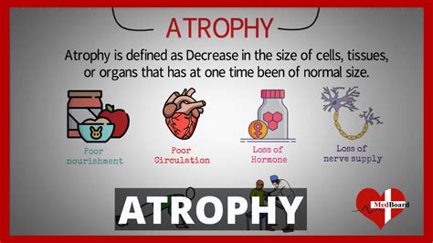 Atrophy -Types and Causes (Made Easy) | What is atrophy? | - YouTube