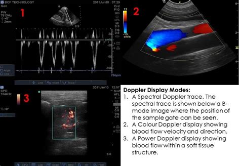 Ultrasound Doppler for Vets | IMV Imaging Academy