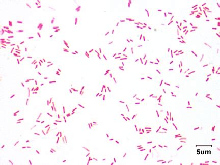 BIOL 230 Lab Manual: Gram Stain of Pseudomonas aeruginosa