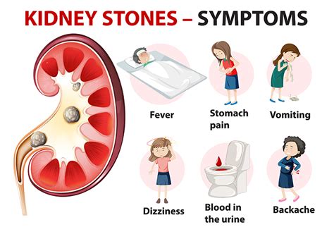 Renal Kidney Stone Treatment: Symptoms and Causes | Dr. Irfan Shaikh | Urolife Clinic, Pune