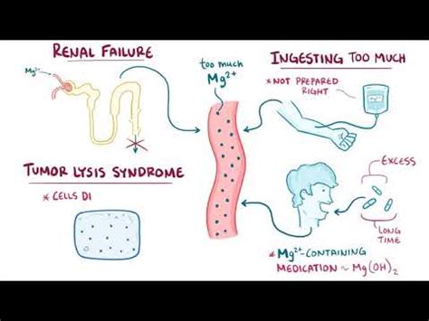 Hypermagnesemia causes, symptoms, diagnosis, treatment, pathology - YouTube