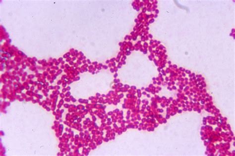 Micrococcus luteus | Microbiology, Molecular biology, Biology